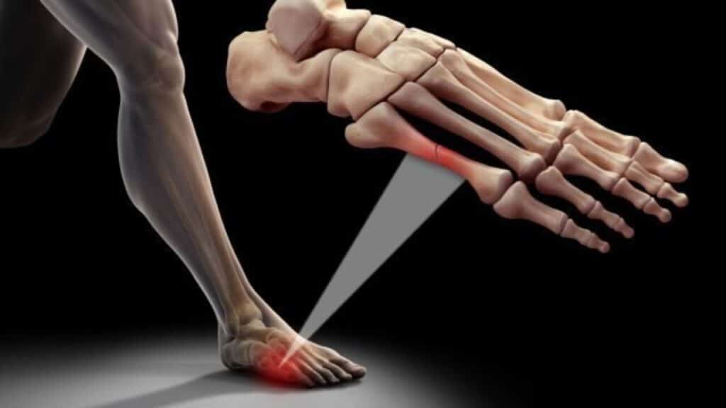Síntoma poco conocido y doloroso en los pies: calcetines apretados pueden causar estrés a las piernas y tobillos
